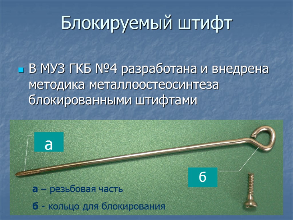 Блокируемый штифт В МУЗ ГКБ №4 разработана и внедрена методика металлоостеосинтеза блокированными штифтами а